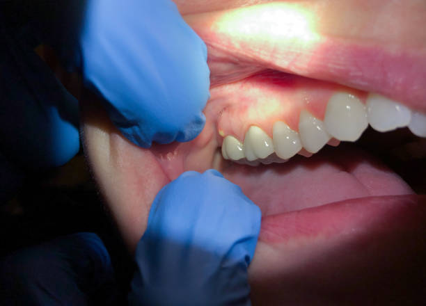 Best Pediatric Emergency Dentist in Colville, WA